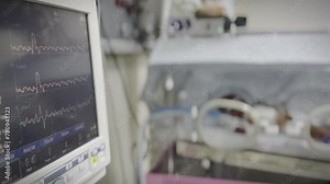 Monitor of Neonatal Intensive care unit, a premature baby in incubator, monitoring the vital signs and ECG of the patient