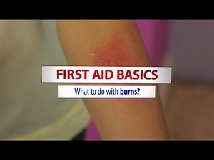 Basic first aid treatment for burns