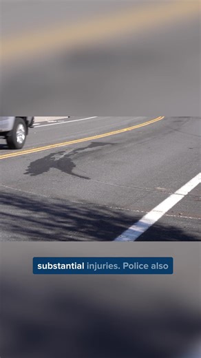 229K views · 440 reactions | ICYMI: DUI charges have been dropped against an off-duty Reno firefighter who was involved in a head-on crash in northwest Reno back in March. The Washoe County District Attorney's office said Shawn Price's blood wasn't drawn in time so he's now being charged with reckless driving — a lesser felony. Full story: https://mynews4.com/news/local/why-was-dui-charge-dropped-case-against-off-duty-reno-firefighter-who-caused-crash-northwest | KRNV News 4 | Facebook