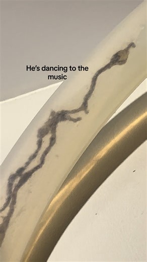 Woah #parasite #colonics #woodsgravity #colonhydrotherapy | colonic