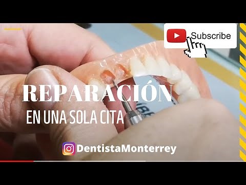 Dental Prosthesis Repair 👅 Step by Step in 1 Appointment