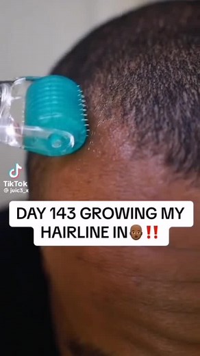 #greenscreenvideo #greenscreen He's up #fyp #sunsetsl