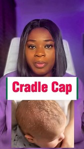 Know the common causes and symptoms of cradle cap in babies with the home remedies. #boratmedicals #pregnancy #pregnant #instagood #antenatal #photooftheday #instagram #instalike #instadaily | Emetuobi Bukola