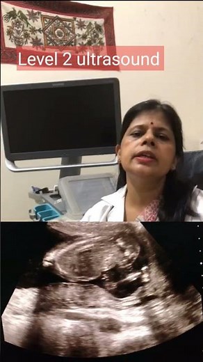 Why is Level 2 Ultrasound / Anomaly scan necessary?