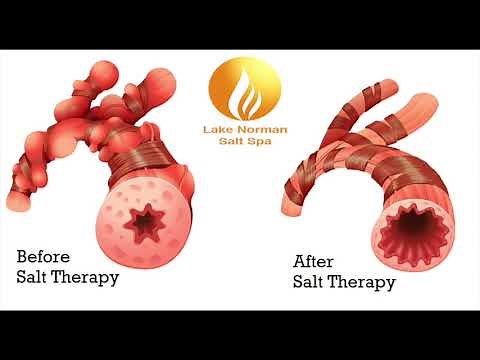 Halotherapy Explained @LKNSaltSpa