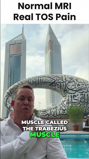 TOS Explained: Why Thoracic Outlet Syndrome Pain Persists Despite Normal MRI Results