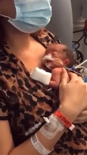 My Preemie 24 Weeks Baby Life Journey😢 #prematurebaby #baby #newbornbaby #preemiebaby #24weeksbaby