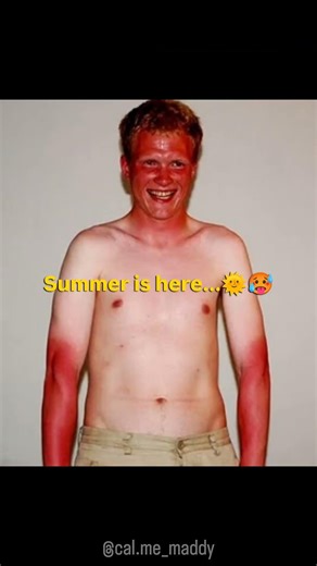 Summer is here 🌞🥵 #shorts #summer #indiansummer #hotweather