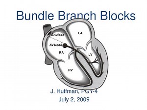 Bundle Branch Blocks - SlideServe