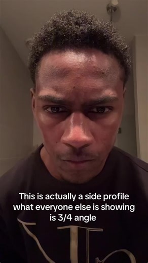 Understanding Side Profile vs. 3/4 Angle in Mewing