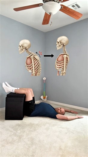 Comment “KYPHOSIS” below for lifetime access to my 20-Week Program. If you struggle with a rounded upper back, forward head, or that “hunched” look… this routine is for you. These 4 corrective exercises help gently decompresses the spine, resets the pelvis, and allow your rib cage and upper back to begin falling back into proper alignment—creating the foundation needed to improve kyphosis. #kyphosis #posturecorrection #forwardheadposture #roundedshoulders #upperbackpain #spinalalignment | Postur