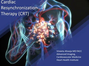 Cardiac Resynchronization Therapy (CRT) - SlideServe