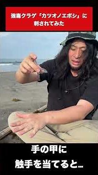 [Electric jellyfish] This is what happens when you get stung by a Portuguese man-of-war