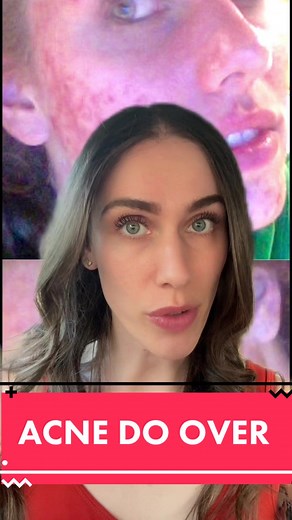 Dear 16 Year Old Me - Acne Skincare Tips and Advice