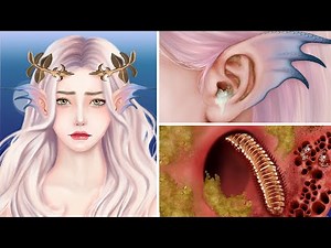 ASMR Mermaid Ear Deep Cleaning & Remove Infection Animation