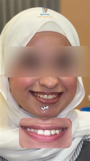 تقويم الاسنان