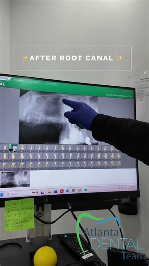 Sometimes saving the tooth makes all the difference for your smile.