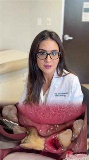 Hydroxyapatite Toothpaste: The Game Changer for Gum Health