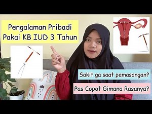 EXPERIENCE OF USING IUD/SPIRAL CONTRACEPTION FOR 3 YEARS // WHAT ARE THE EFFECTS?