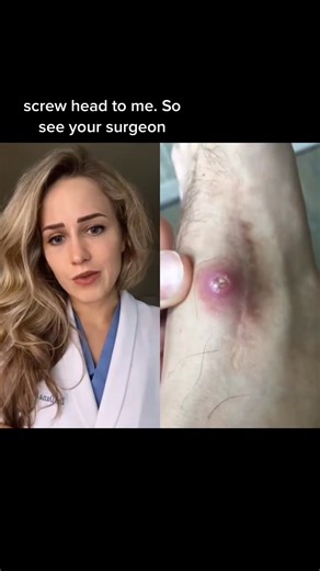 Not all bumps should be popped 😳 #cyst #oddlysatisfying #education #foot #health #foothealth #healthfacts #doctor #doctors #doctorsoftiktok #medicine #medical #medicalhumor #medicalvideos #surgery #nurse #nurses #podiatry #podiatrist #podiatric #surgeon #surgeons #footsurgeon #healthcare #scrublife | Footdocdana