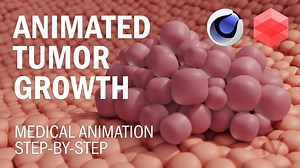 C4D Redshift 医学动画之肿瘤增长（中英文字幕）