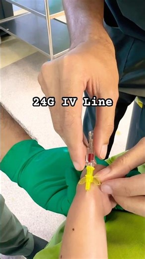 Struggling with Small Veins? Try a 24G IV Line. #anesthesia #anesthesiaresident #icu #intravenous