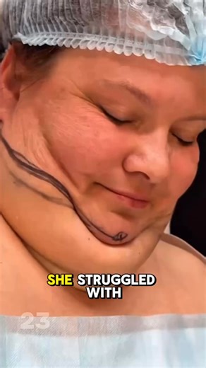 17K views · 75 reactions | You Won’t Believe How Dramatically Her Look Changed After This Simple Surgery... Results in Comments  | Family Time | Facebook