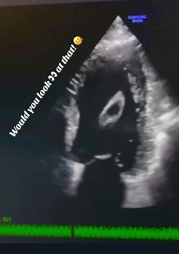 Echocardiography Student Reaction:
