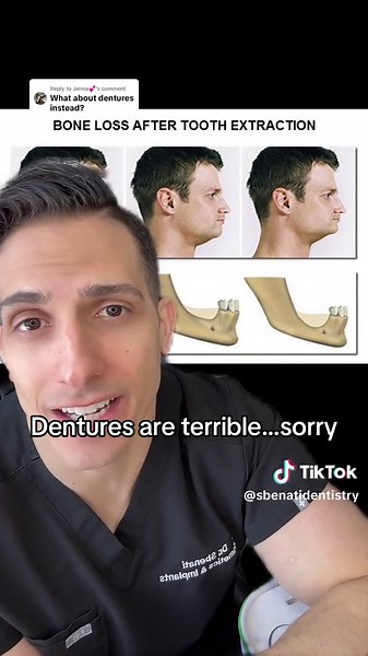 Understanding the Impact of Dentures on Oral Health