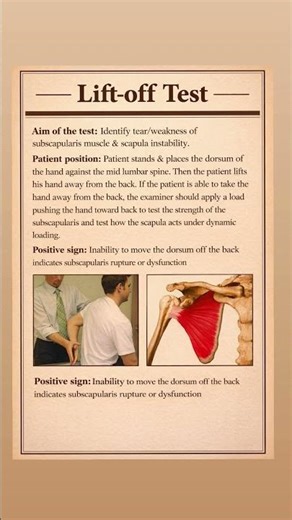 Lift-off Test——Aim of the test: Identify tear/weakness of subscapularis muscle & scapula