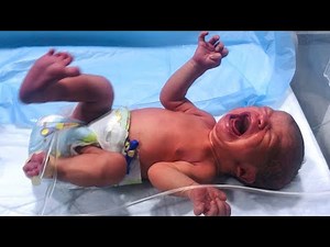 "Crying So Loud During Care 💔 | What Baby Feels in NICU 🍼👶 #NICUBaby #BabyCare"