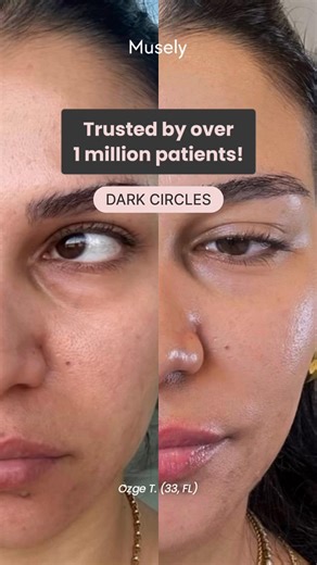 18 reactions | Why do over 1 million patients trust Musely? REAL RESULTS ✨ Treat dark spots, aging skin, hair loss, rosacea, and more with science-backed, custom formulas. Order in just 3 minutes and have prescription treatments delivered directly to your doorstep. Get started at Musely.com! | Musely | Facebook