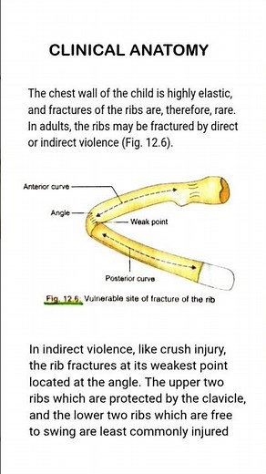 Clinical Anatomy: Rib Fractures and Weak Points Explained