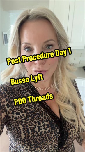 Follow me during my recovery from a Busso Lyft or Thread lift. Post procedure Day 1! #antiaging #glowup #skincare #filler #fyp