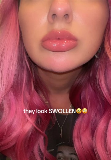 Lip Plumper Gloss: Before & After Results