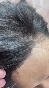 hello, we are back! Please feel free to DM us here Or WhatsApp https://wa.me/8617561788028 https://bit.ly/3JbBQ1d | Bono Hair-Hair Replacement Factory