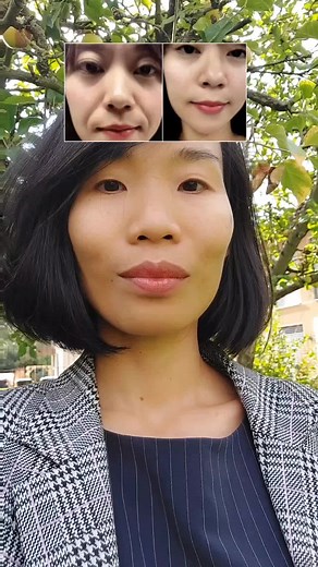 how to reduce nasolabial folds, aka laugh lines , with a simple face yoga/ face exercise. no need to filler, botox, and it's free. Work out your face muscles just like you do with your body. There are 42 individual muscles on your face underneath your skin. It is worth learning how to activate all your face muscles individually with face yoga. One study found that performing regular facial exercises over the course of 20 weeks led to fuller cheeks and a more youthful appearance. Face yoga enable