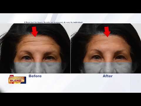 Actress Annette Figueroa Shows Us How Amazing Plexaderm Is!