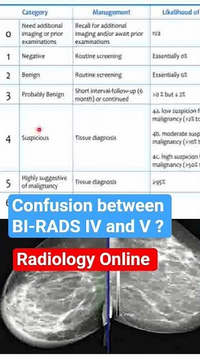 Get Rid of confusion between BI-RADS IV and V | Radiology by Dr. Sam