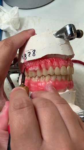 Explore Denture Festooning with Luke Kahng