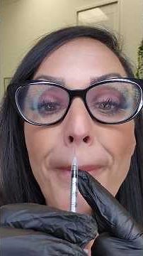 Botox Nose Lift - How to do a nose lift with neurotoxin