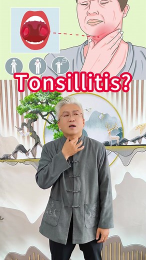 扁桃体炎的症状与治疗方法