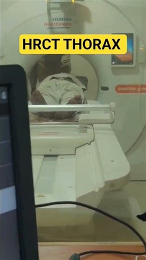 (HRCT) scan of the chest is the cornerstone imaging modality for interstitial lung disease (ILD