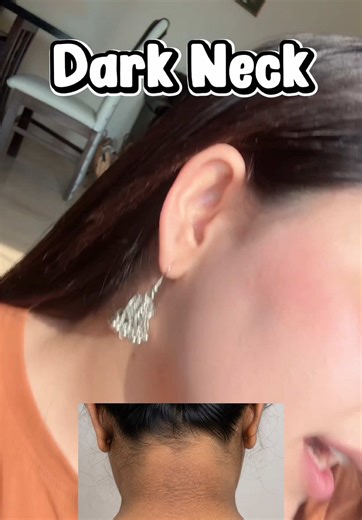 Reduce Dark Neck Pigmentation with Glycolic Acid Toner
