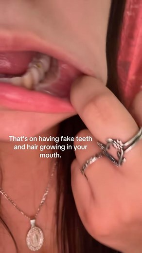 TheBentist | Why Does This Girl Have HAIRY Teeth?! 🦷😮 #teeth #jaw #dentist | Instagram