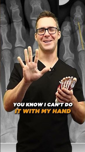 Why are My Toes SEPARATING? [ Causes, Symptoms]