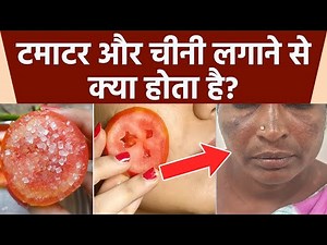 टमाटर चीनी लगाने से क्या होता है। चेहरे पर टमाटर चीनी लगाने के फायदे।Boldsky*Health