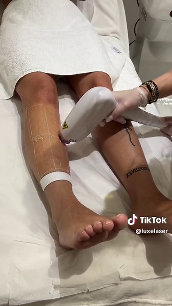 Laser hair removal! By Corina Based in 180 Finchley Road,London,NW3 6BP #london #fyp #laserhairremoval #letyourskinthrive #letyourskinbreathe #men #women #ldn #finchley #skincare #hairfreelaserclinic #hairfree #capcut #trending #foryou #viral #fypシ #🇷🇴 #🇬🇧