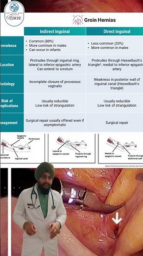 🚨 Direct vs Indirect Inguinal Hernia... one of the most confusing anatomy topics! 🤯