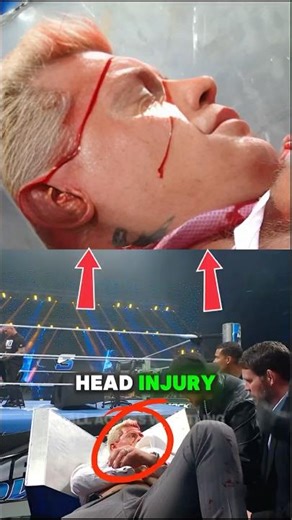 Did Cody Rhodes Suffer A Real Head Injury On Smackdown? 😲 #wwe